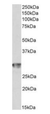 CD4 antibody