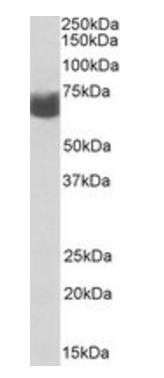 AMHR2 antibody