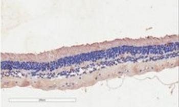 CNGB3 antibody