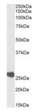 Goat anti-CSNK2B (aa172-186) Antibody