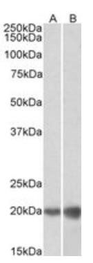 Goat anti-dUTPase / DUT Antibody
