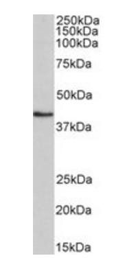 Goat anti-HMBS (aa160-173) Antibody