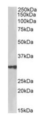 Goat anti-HSD17B3 (aa141-155) Antibody