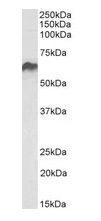 HSPD1 antibody
