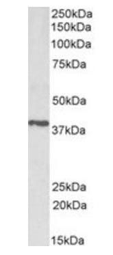 Goat anti-PTGR2 / ZADH1 Antibody