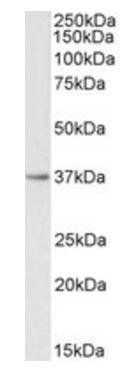 PTGR1 antibody