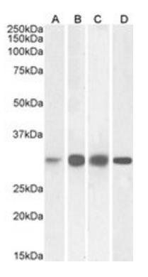 Goat anti-Ketohexokinase Antibody