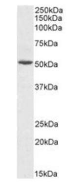 Goat anti-ALT1 / GPT1 (aa391-405) Antibody
