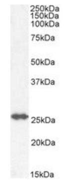 GSTM4 antibody