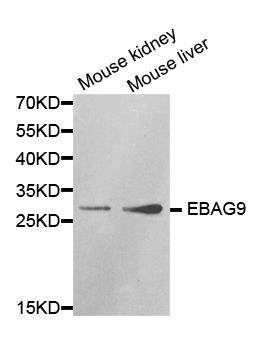 EBAG9 antibody