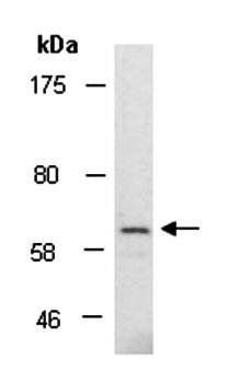 EBF3 (C2) Antibody, Rabbit Polyclonal