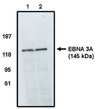 EBNA 3A antibody