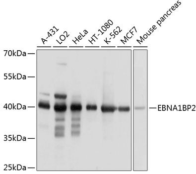 EBNA1BP2 antibody