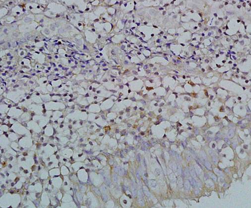 EBNA 3A Rabbit Polyclonal Antibody
