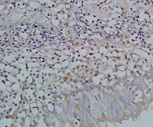 EBNA 3A antibody