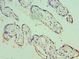 ECE1 Antibody