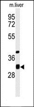 ECHDC1 antibody