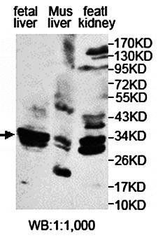 ECHDC1 antibody