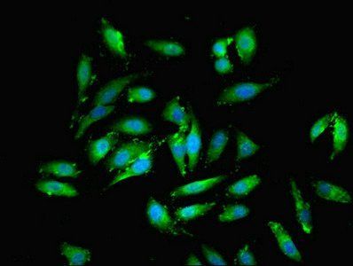 Echinoderm microtubule-associated protein-like 2 antibody