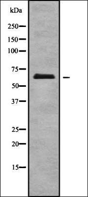 ECM1 antibody