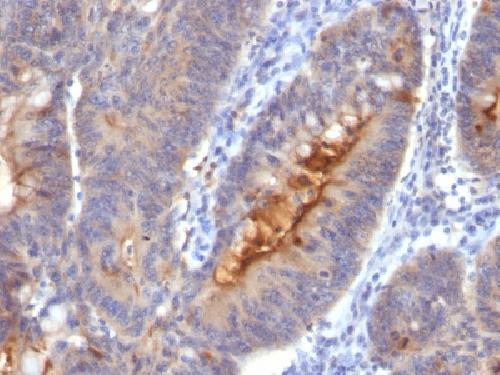 IgA Secretory Component / ECM1 Antibody