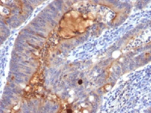 IgA Secretory Component / ECM1 Antibody