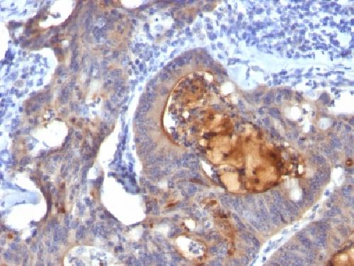 IgA Secretory Component / ECM1 Antibody