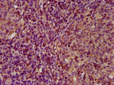 ECM1 antibody