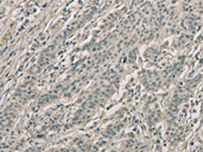 RNASE3 Antibody