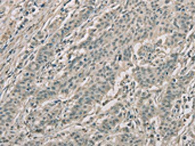 ECP antibody