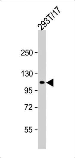 ECT2 antibody