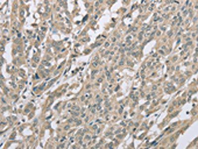 EDA2R Antibody