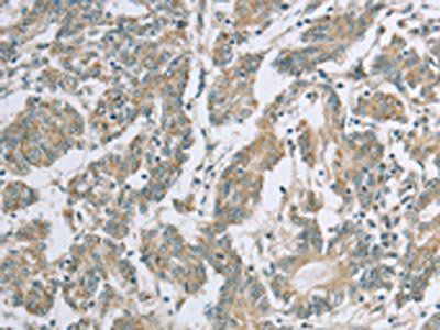 EDA2R Antibody