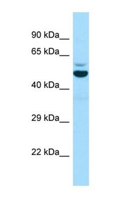 EDC3 antibody