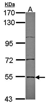 Edc3 antibody