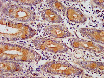EDC4 Antibody