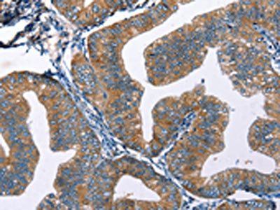 EDN2 antibody