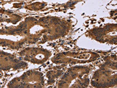 EDN2 Antibody