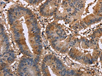 EDN2 Antibody
