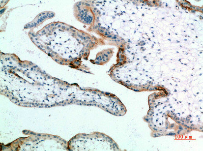 EDNRB Antibody