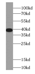 EEF1D antibody