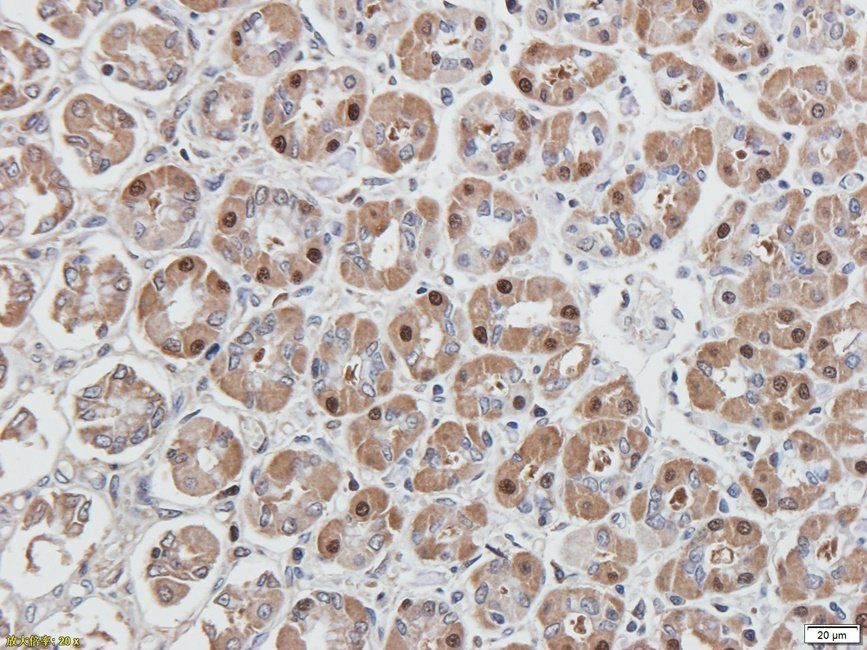 eEF2 antibody