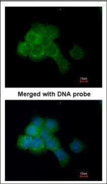 eEF2K antibody [N1N3]