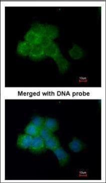 eEF2K antibody