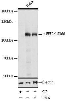 EEF2K (Phospho-S366) antibody