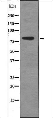 eEF2K (Phospho-Ser359) antibody