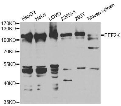 EEF2K antibody