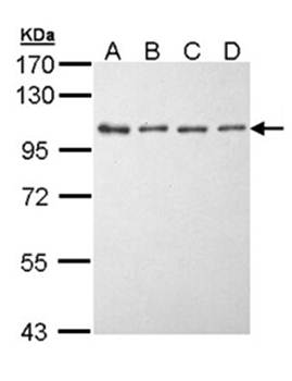 EEF2K antibody