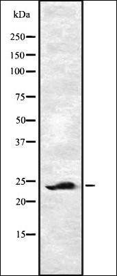 EF-1 beta antibody
