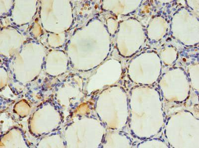 EFCAB14 antibody